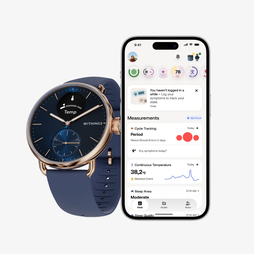 Scanwatch 2 - Rosegold Blue - Image 5